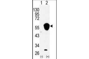 Image no. 1 for anti-Aldehyde Dehydrogenase 3 Family, Member A1 (ALDH3A1) (N-Term) antibody (ABIN360202) (ALDH3A1 anticorps  (N-Term))