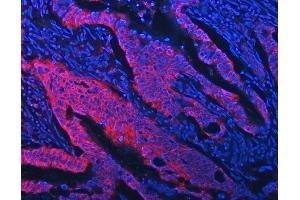 IF analysis of STON1 using anti-STON1 antibody (ABIN7599896). (STON1 anticorps  (AA 127-688))