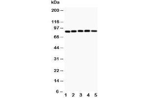 Western blot testing of IKK alpha antibody and Lane 1:  MCF-7;  2: SGC;  3: PANC;  4: HeLa;  5: mouse heart