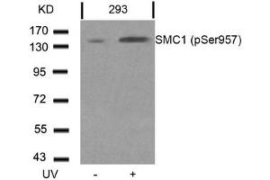 Western blot analysis of extracts from 293 cells untreated or treated with UV using SMC1(Phospho-Ser957) Antibody. (SMC1A anticorps  (pSer957))