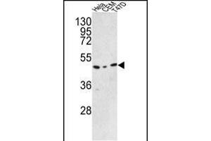 Western blot analysis of C9orf156 Antibody (C-term) (ABIN390925 and ABIN2841127) in Hela, CEM, T47D cell line lysates (35 μg/lane). (C9orf156 anticorps  (C-Term))