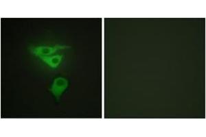 Immunofluorescence analysis of HepG2 cells, using PDLIM1 Antibody. (PDLIM1 anticorps  (AA 61-110))