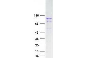Validation with Western Blot