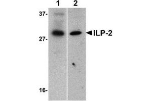 Western blot analysis of ILP-2 expression in human HepG2 (lane 1) and MOLT4 (lane 2) cell lysates with AP30430PU-N ILP-2 antibody at 1 μg/ml.