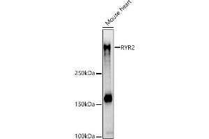 Western blot analysis of extracts of Mouse heart, using RYR2 antibody (ABIN1513493, ABIN3020906, ABIN3020907 and ABIN6213787) at 1:710 dilution. (RYR2 anticorps  (AA 4850-4950))