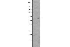 Western blot analysis of BIN2 expression in HepG2 whole cell lysate ,The lane on the left is treated with the antigen-specific peptide.