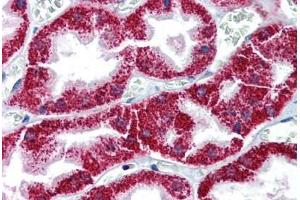 Human Kidney (formalin-fixed, paraffin-embedded) stained with BAX antibody ABIN337236 at 10 ug/ml followed by biotinylated anti-mouse IgG secondary antibody ABIN481714, alkaline phosphatase-streptavidin and chromogen. (BAX anticorps)