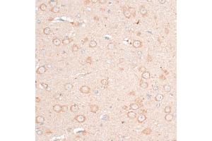 Immunohistochemistry of paraffin-embedded mouse brain using CDH18 antibody (ABIN6291131) at dilution of 1:100 (40x lens). (CDH18 anticorps)