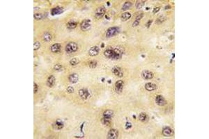 Image no. 3 for anti-Prospero Homeobox 1 (PROX1) (Center) antibody (ABIN357418)