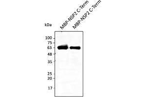 Western Blotting (WB) image for anti-SARS-CoV-2 Non-Structural Protein 2 (NSP2) (C-Term) antibody (ABIN7272997) (SARS-CoV-2 NSP2 anticorps  (C-Term))