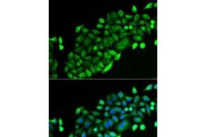 Immunofluorescence analysis of U2OS cells using GSTO2 Polyclonal Antibody (GSTO2 anticorps)