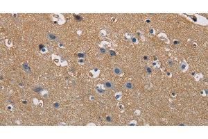 Immunohistochemistry of paraffin-embedded Human brain tissue using GSTA2 Polyclonal Antibody at dilution 1:50 (GSTa2 anticorps)