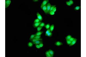 Immunofluorescence staining of HepG2 cells with ABIN7146858 at 1:333, counter-stained with DAPI.