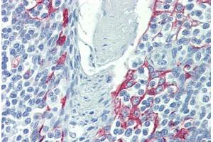 Tonsil, Human: Formalin-Fixed, Paraffin-Embedded (FFPE)
