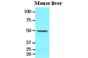 Western Blotting (WB) image for anti-Epoxide Hydrolase 1, Microsomal (Xenobiotic) (EPHX1) (AA 21-455) antibody (ABIN371867)