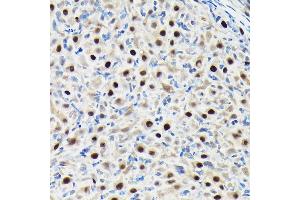 Immunohistochemistry of paraffin-embedded rat ovary using GTPBP4 Rabbit pAb (ABIN1680142, ABIN3019054, ABIN3019055 and ABIN6220689) at dilution of 1:50 (40x lens). (GTPBP4 anticorps  (AA 385-634))