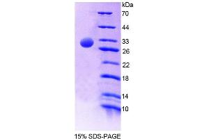 SDS-PAGE (SDS) image for Protein tyrosine Phosphatase, Non-Receptor Type 5 (Striatum-Enriched) (PTPN5) (AA 331-558) protein (His tag) (ABIN4989865) (PTPN5 Protein (AA 331-558) (His tag))
