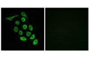 Immunofluorescence analysis of A549 cells, using RPS12 antibody.