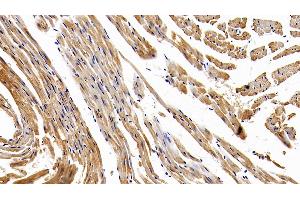Detection of NPPB in Mouse Cardiac Muscle Tissue using Polyclonal Antibody to Natriuretic Peptide Precursor B (NPPB)