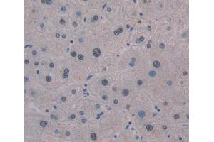 IHC-P analysis of liver tissue, with DAB staining. (SMUG1 anticorps  (AA 1-270))