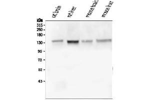 Western blot analysis of GM130 using anti-GM130 antibody (ABIN6719433).