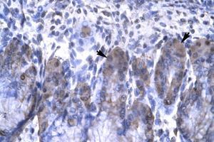 anti-Orthodenticle Homeobox 2 (OTX2) (AA 86-135) antibody