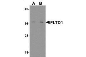 Western blot analysis of IFLTD1 in rat liver tissue lysate with IFLTD1 antibody at (A) 1 and (B) 2 ug/mL. (PAS1C1 anticorps  (Middle Region))