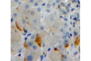 Used in DAB staining on fromalin fixed paraffin-embedded Liver tissue