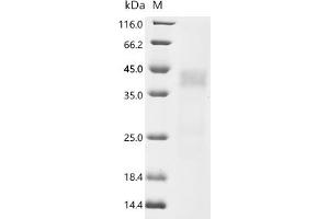 (Tris-Glycine gel) Discontinuous SDS-PAGE (reduced) with 5 % enrichment gel and 15 % separation gel.