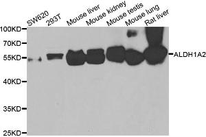 Western blot analysis of extracts of various cell lines, using ALDH1A2 antibody (ABIN4902887) at 1:1000 dilution.