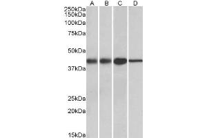 ABIN571082 (0. (ACAT1 anticorps  (AA 257-269))