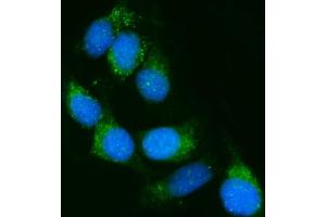 IF analysis of Calnexin/CANX using anti-Calnexin/CANX antibody (ABIN7602290).