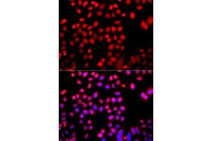 Immunofluorescence analysis of A549 cells using CFL2 antibody. (Cofilin 2 anticorps  (AA 1-166))