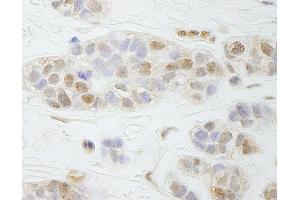 Immunohistochemistry (IHC) image for anti-Partner and Localizer of BRCA2 (PALB2) (AA 200-250) antibody (ABIN7448714)