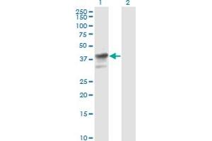 Western Blot analysis of MAPK3 expression in transfected 293T cell line by MAPK3 monoclonal antibody (M04), clone 1F7. (ERK1 anticorps  (AA 279-379))
