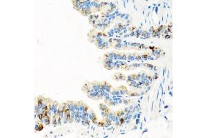 Immunohistochemistry of paraffin-embedded mouse lung using RGS5 antibody (ABIN6130676, ABIN6146924, ABIN6146925 and ABIN6222790) at dilution of 1:100 (40x lens). (RGS5 anticorps  (AA 1-181))