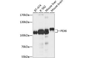 Western blot analysis of extracts of various cell lines, using PEX6 antibody (ABIN6133134, ABIN6145472, ABIN6145473 and ABIN6214721) at 1:1000 dilution. (PEX6 anticorps  (AA 741-980))