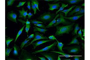 Immunofluorescence of purified MaxPab antibody to LDHA on HeLa cell.