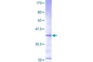 Image no. 1 for Chemokine (C-X-C Motif) Ligand 6 (CXCL6) (AA 1-114) protein (GST tag) (ABIN1350828)