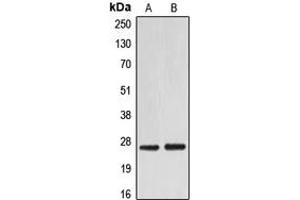 Western blot analysis of EIF4E expression in HEK293T (A), NIH3T3 (B) whole cell lysates. (EIF4E anticorps  (C-Term))