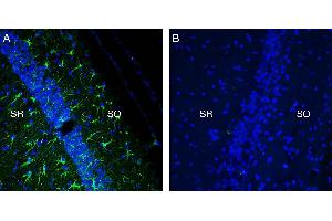 Expression of TREM2 in mouse hippocampus in a kainic acid neurodegeneration model. (TREM2 anticorps  (Extracellular, N-Term))