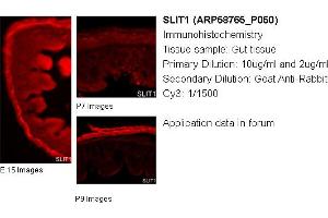 Image no. 1 for anti-Slit Homolog 1 (SLIT1) (Middle Region) antibody (ABIN504532) (SLIT1 anticorps  (Middle Region))