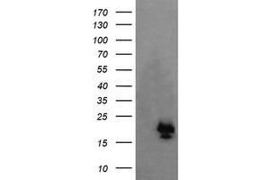 Image no. 1 for anti-NFKB Inhibitor Interacting Ras-Like 1 (NKIRAS1) antibody (ABIN1499742) (NKIRAS1 anticorps)