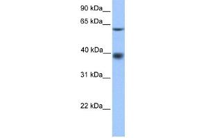 WB Suggested Anti-MFSD4 Antibody Titration: 0. (MFSD4 anticorps  (N-Term))