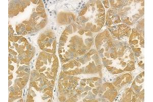 ABIN6258318 and ABIN6275481 at 1/100 staining human normal kidney tissue by IHC-P. (RGS5 anticorps  (Internal Region))