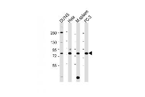 All lanes : Anti-HRD1 Antibody  at 1:2000 dilution Lane 1: D whole cell lysate Lane 2: Hela whole cell lysate Lane 3: mouse spleen lysate Lane 4: PC-3 whole cell lysate Lysates/proteins at 20 μg per lane.