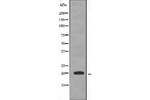Western blot analysis of extracts from Jurkat cells using PP14C antibody. (PPP1R14C anticorps  (Internal Region))