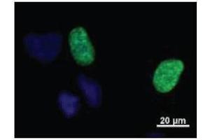 Localization of human GTF2IRD1 in HeLa cells.