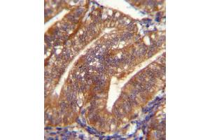 POSTN Antibody immunohistochemistry analysis in formalin fixed and paraffin embedded human uterus tissue followed by peroxidase conjugation of the secondary antibody and DAB staining. (Periostin anticorps  (C-Term))