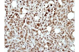 IHC-P Image Immunohistochemical analysis of paraffin-embedded PC9 xenograft, using RING1, antibody at 1:500 dilution.